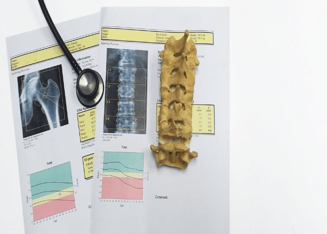 vitamin D and osteoporosis