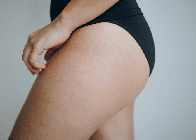 Squats, deadlifts, and lunges are great for buttock toning