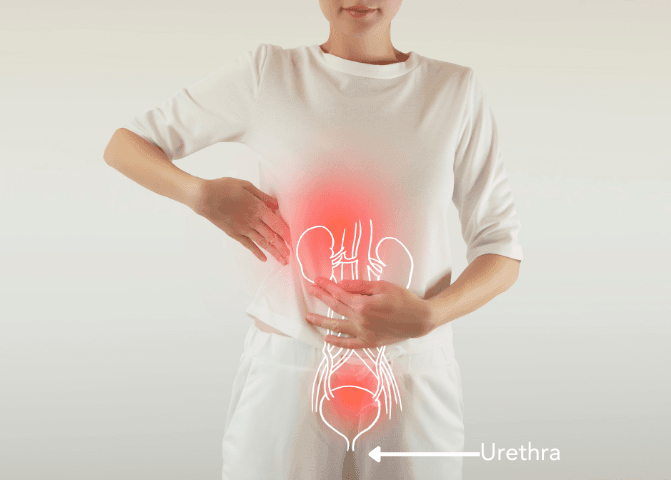 Women have a short urethra, increasing risk of UTI.